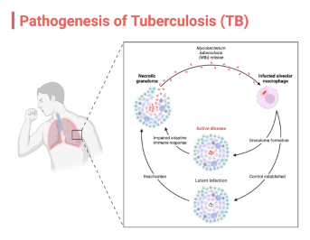 Tuberculosis (TB)